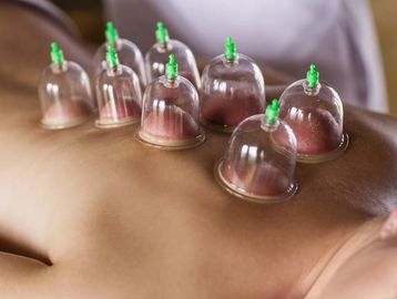 Woman receiving Cupping on her back for pain relief and blood flow circulation