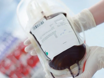 OnDemand Mobile Lab provides professional Therapeutic Phlebotomy services