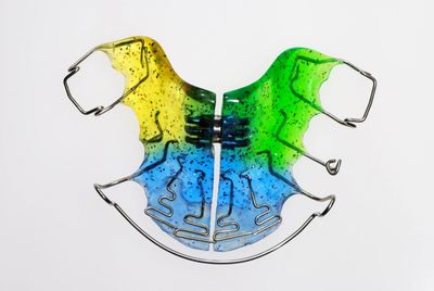 Phase 1 Appliances: Early Orthodontic Treatment for Children