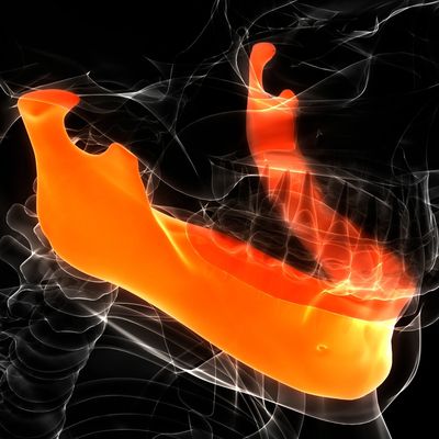 Surgical Orthodontic Cases