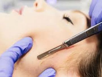 dermaplaning