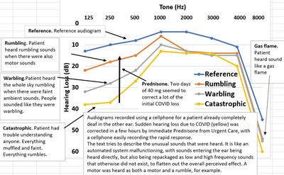 Audiogram tone plot along with descriptions for what was heard with sudden hearing loss due to COVID