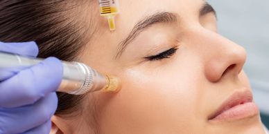 Woman Doing Plasma Facial Skin Rejuvenation Treatment