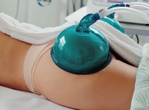 Buttocks Vacuum Lifting Therapy Treatment