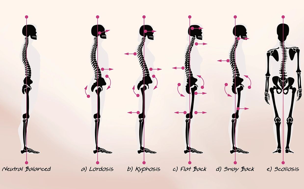 Yoga for Back care alignment infographic