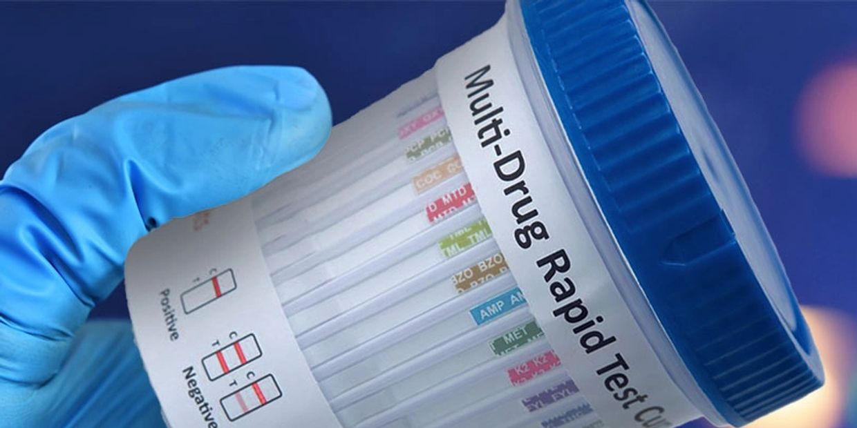 Gloved hand holding a multi-drug rapid test cup with labeled testing strips.