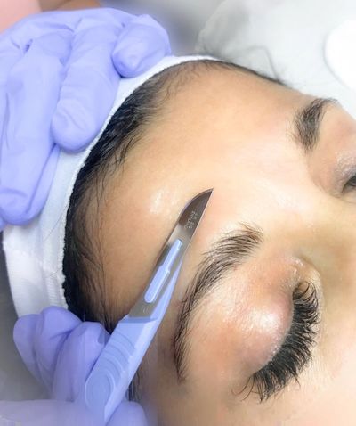 Dermaplaning skin care treatment for glowing skin