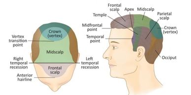 hair transplant needs differ for individuals
multiple scalp areas can be treated