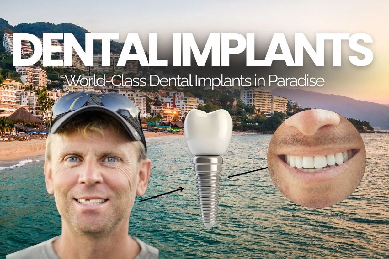Implantes dentales con sonrisa mejorada frente al mar.