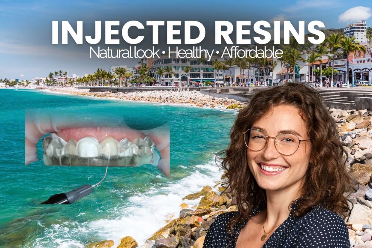 Publicidad de resinas inyectadas para dientes con fondo de playa.