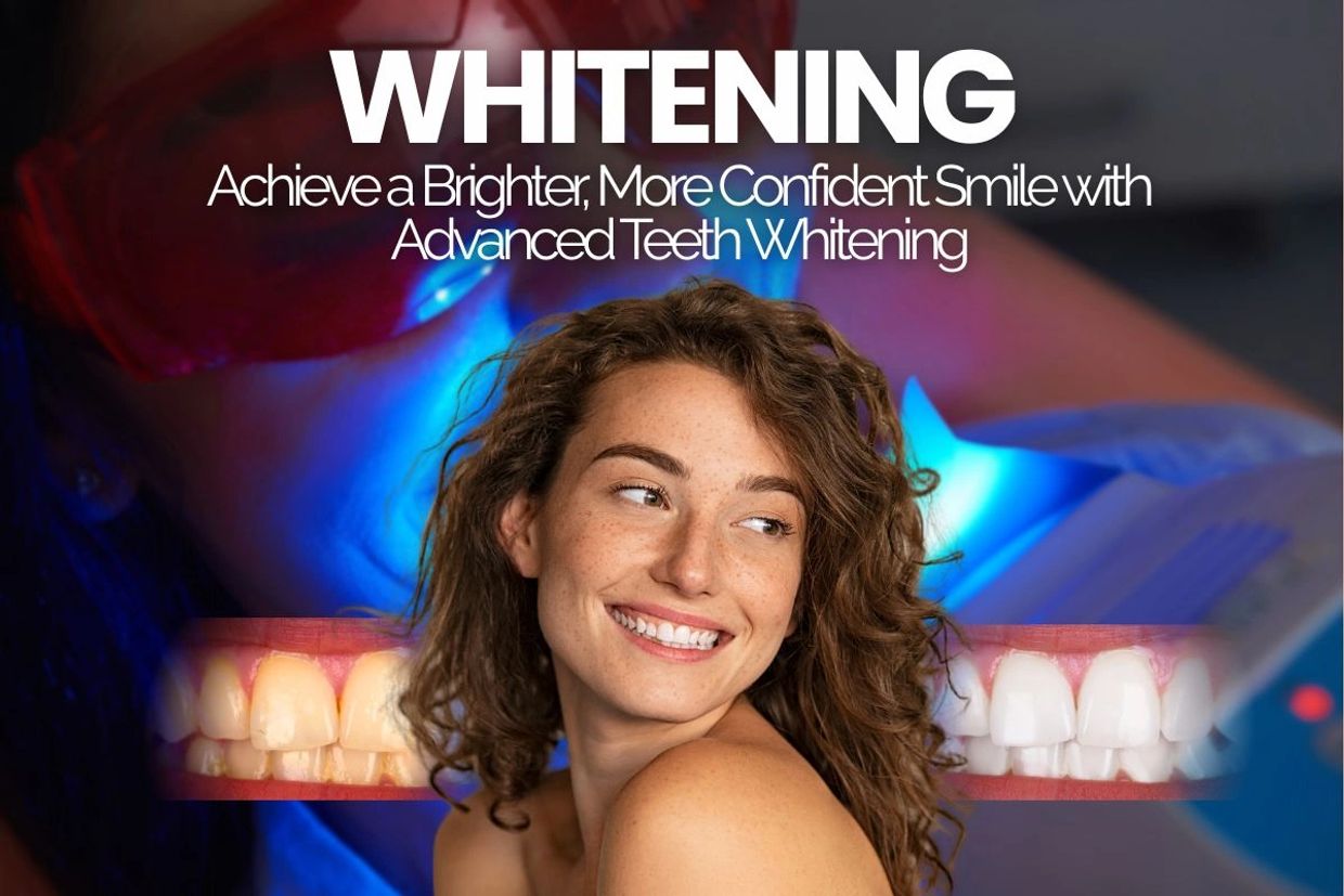Mujer sonriente promocionando blanqueamiento dental avanzado.