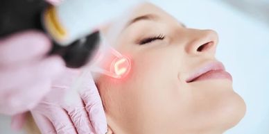 Woman receiving a laser facial treatment.