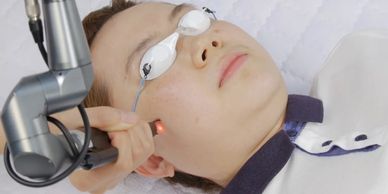 Person undergoing a laser facial treatment with eye protection.