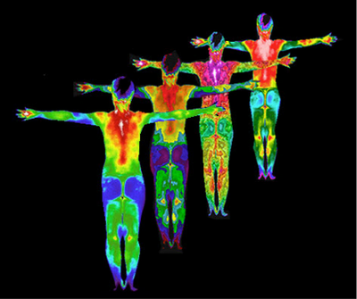 Photo of thermography scans