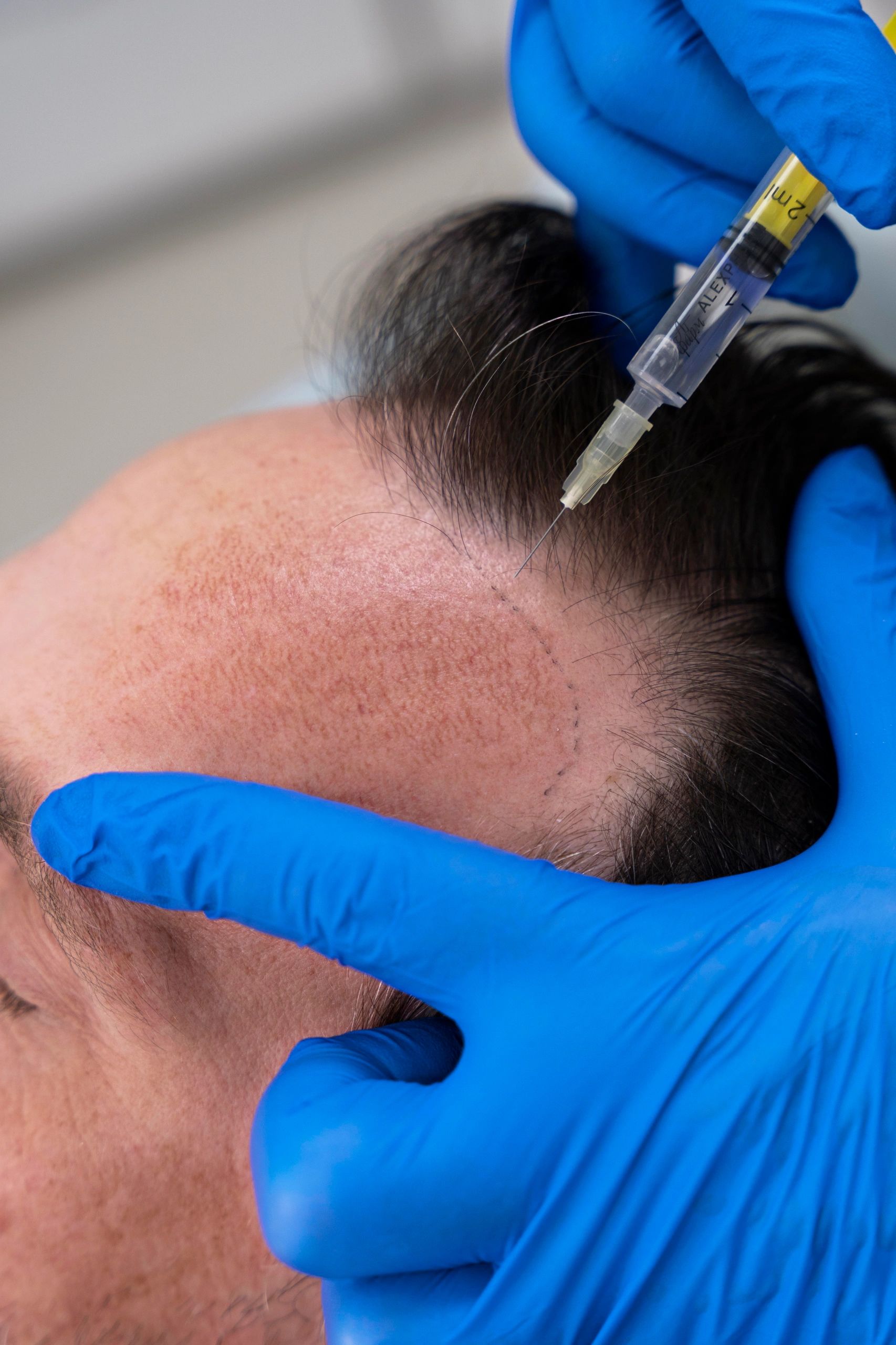 HAIR HAVEN TRANSPLANT CLINIC