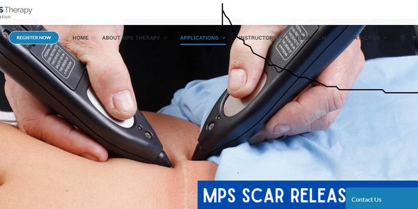 Neurstim scar tissue release 