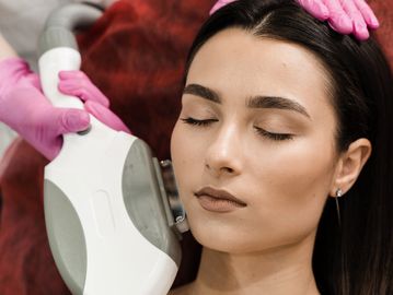 Woman Receiving IPL, IPL hair removal, IPL photorejuvenation