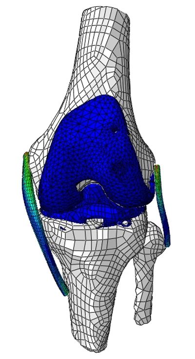 OEMI Lab Knee Finite Element