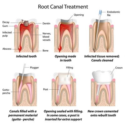 Best dentist in Crossings Republik 