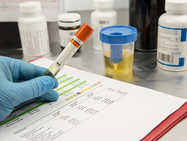 Medical professional reviewing lab test results.
