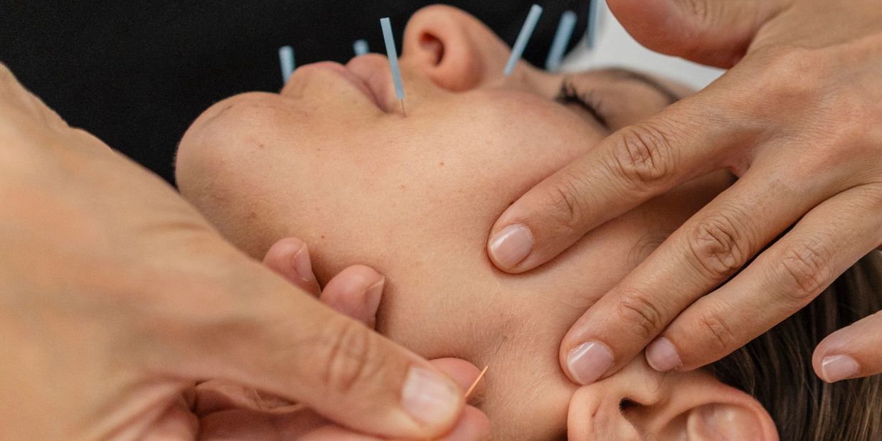 Cosmetic Acupuncture Colorado Springs
Cosmetic Acupuncture Colorado