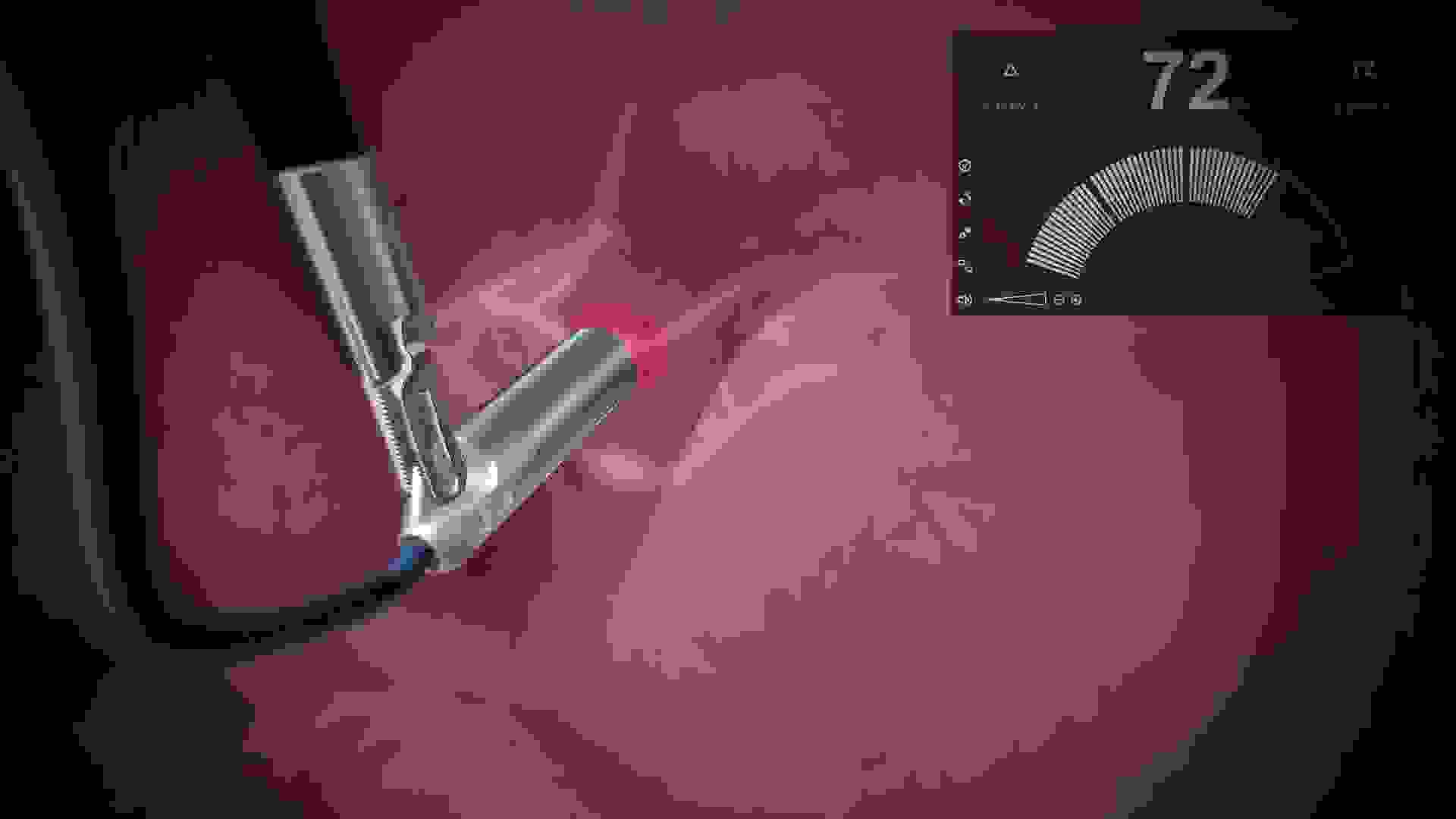 Robotics Drop Probe SENSEI® - Drop-In Gamma Probe, Robotics, Cancer Surgery