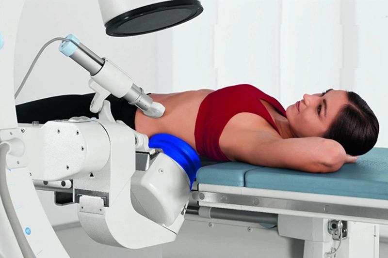 laser-kidney-stone-surgery-in-pune-a2646c0.png