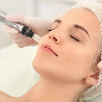 PemSpa microneedling facial near me newton ma. brighten, dry, dull, acne, sensitive skin, aging