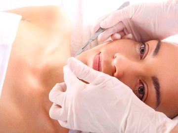 Close-up of esthetician dermaplaning a woman's face using a blade to exfoliate and remove peach fuzz
