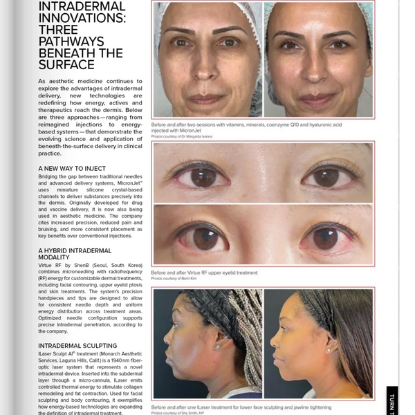 National Publication- Shy Smith, NP-C
