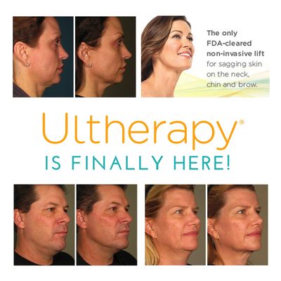 Ulthera Facial Skin Tightening West Island, Montreal - Plastic Surgery