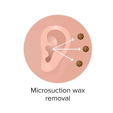 ear wax microsuction