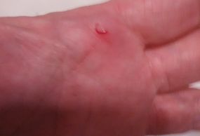 Small cut on a palm.