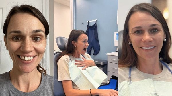 “Permanent Teeth in 24 Hours” isn’t just a promise—it’s a proven breakthrough that began with the in