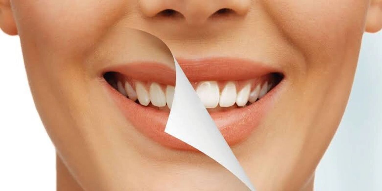 Teeth Whitening in Lucknow
Dr Akhil Agarwal MDS (KGMU) Dentist Smile Orthodontist Dental Clinic