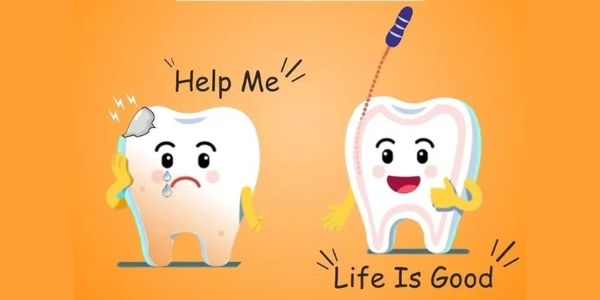 Root Canal Treatment RCT in Lucknow