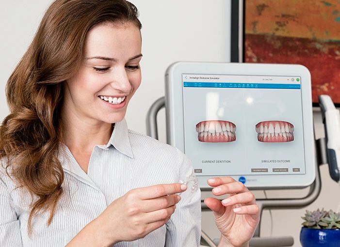 Simulator Scan 3D Scan Smile Simulation