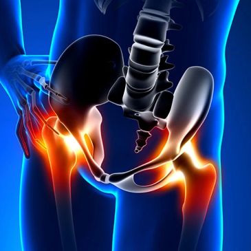 Highlighted pain in hip and pelvic region