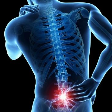 X-ray of a person with lower back pain.