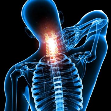 X-ray illustration showing neck pain.