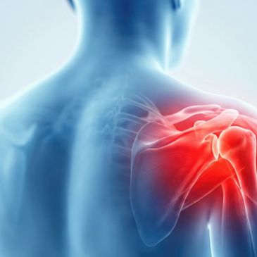 Illustration of shoulder pain in a human body.