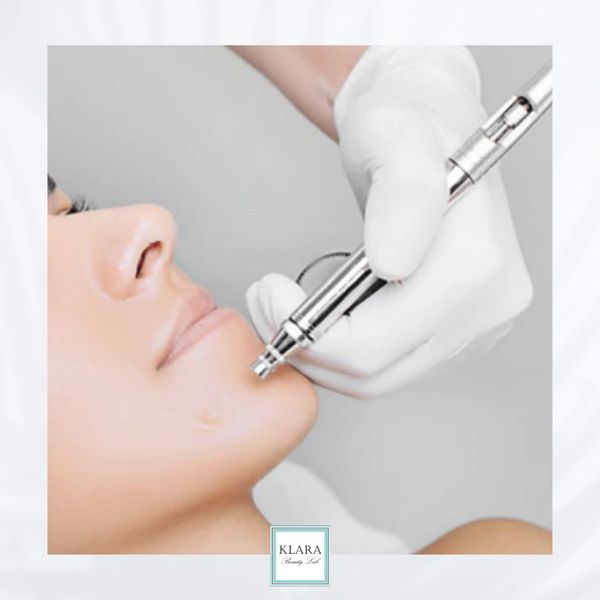 Close-up of facial treatment using a modern device on a woman's chin.