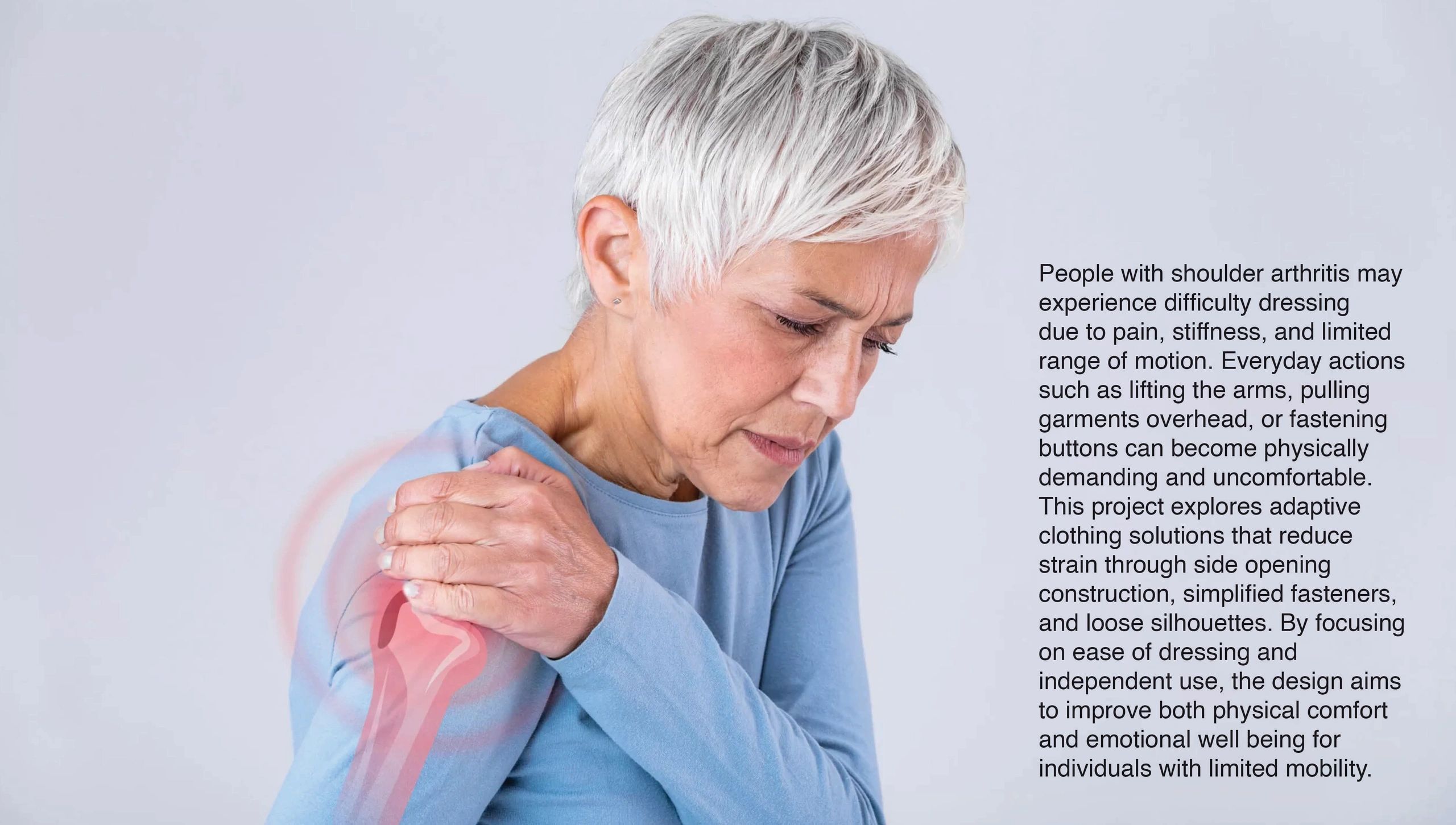 Older woman holding her painful shoulder, highlighting arthritis discomfort.