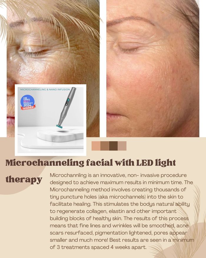 Microchanneling facial with LED therapy $125