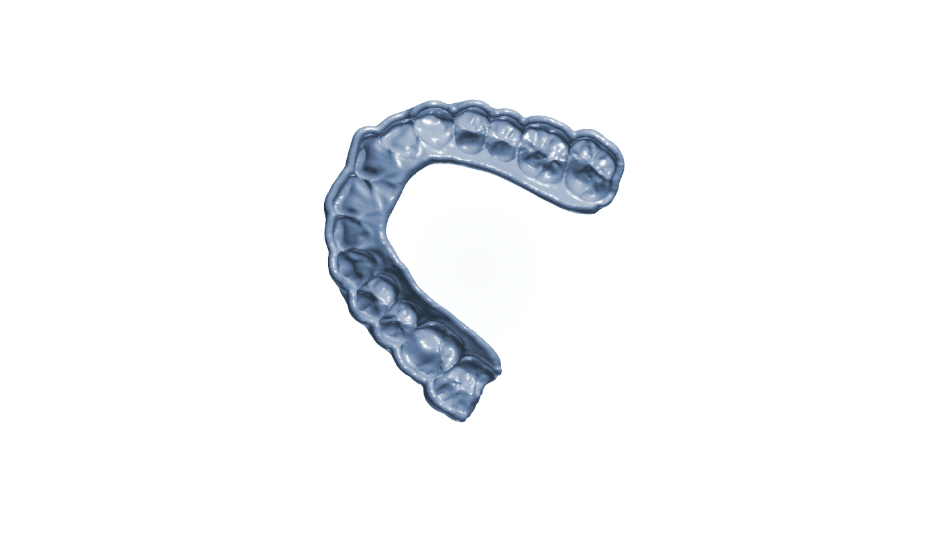 Digital Orthodontic Laboratory - YOUNG ORTHODONTIC LABORATORY