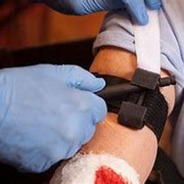 applying tourniquet to bleeding arm
