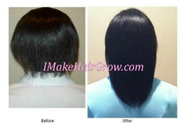 IMakeHairGrow