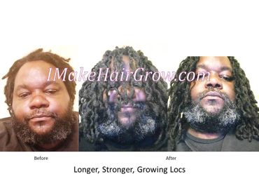 IMakeHairGrow