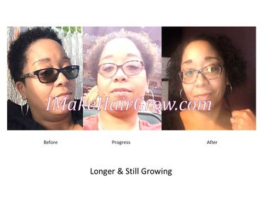 IMakeHairGrow