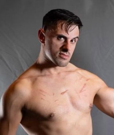 Man with scars on chest looking intense.